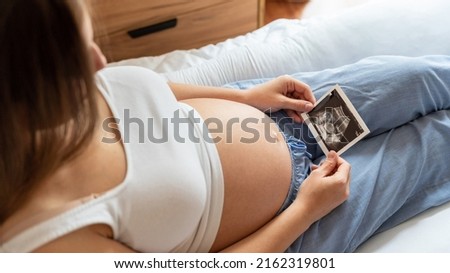 Ultrasound photo pregnancy baby. Woman holding ultrasound pregnant picture. Concept maternity, pregnancy, childbirth Royalty-Free Stock Photo #2162319801