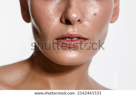 close-up girl with sweaty skin on her face and excessive oily sheen, excessive sweating, hyperhidrosis disease Royalty-Free Stock Photo #2162461531