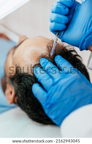 Handsome middle age man receiving advanced Platelet Rich Plasma PRP treatment against hair loss. Modern aesthetics treatments for males. Healthcare and beauty concept. Royalty-Free Stock Photo #2162943045