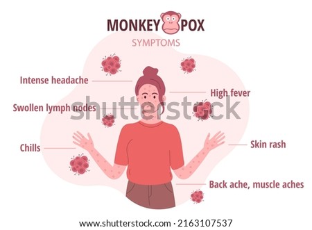 Monkey pox outbreak. Infographics of virus symptoms in humans. Vector illustration for informing people about an infectious disease. Royalty-Free Stock Photo #2163107537
