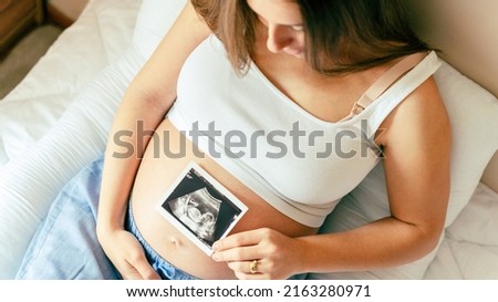 Ultrasound photo pregnancy baby. Woman holding ultrasound pregnant picture. Concept maternity, pregnancy, childbirth Royalty-Free Stock Photo #2163280971