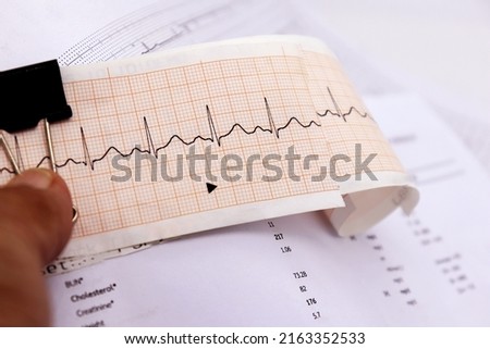 heart rhythm ekg note on paper Doctors use it to analyze heart disease treatments. illustration on a white background Royalty-Free Stock Photo #2163352533