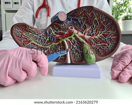 Surgeon hand holds scalpel over anatomical figure of human liver. Process of surgical treatment of liver diseases cancer echinococcal infection Royalty-Free Stock Photo #2163620279