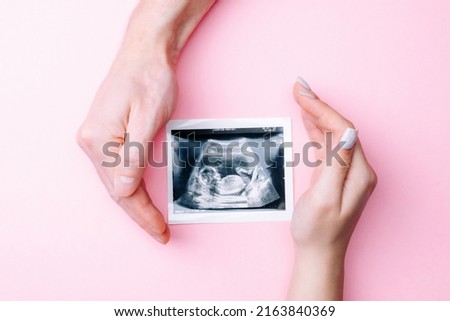 Ultrasound image pregnant baby photo. Woman hands holding ultrasound pregnancy picture on pink background. Pregnancy, medicine, pharmaceutics, health care and people concept Royalty-Free Stock Photo #2163840369