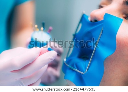 Endodontic Root Canal Treatment Process  Royalty-Free Stock Photo #2164479535