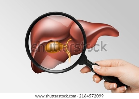 Human liver disease, diagnosis and liver treatment. Doctor showing liver anatomical model for treatment hepatitis, cancer Royalty-Free Stock Photo #2164572099