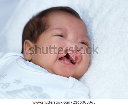 Hoping her cries dont go unheard. Closeup shot of a baby girl with a cleft palate. Royalty-Free Stock Photo #2165388063