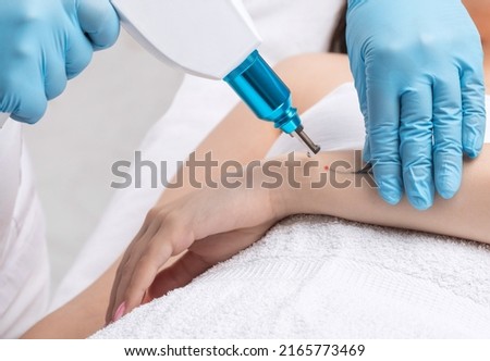 The doctor makes the procedure for laser tattoo removal on the girl's arm. Royalty-Free Stock Photo #2165773469