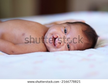 She wont let her birth defect get her down. Portrait of a baby girl with a cleft palate lying on a bed. Royalty-Free Stock Photo #2166778821