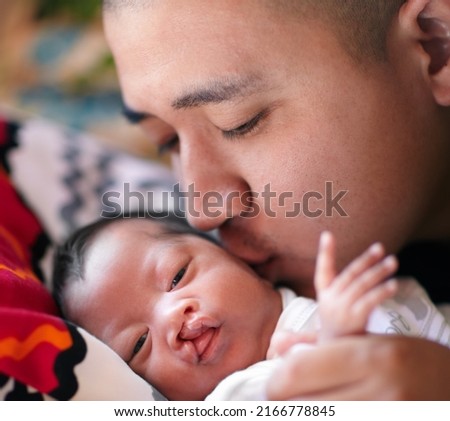 The loving kiss of a father. Shot of a young father giving his baby girl who has a cleft palate a kiss on the cheek. Royalty-Free Stock Photo #2166778845