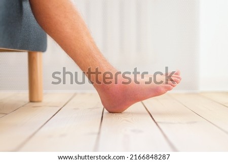 Ankle sprained. Close up of swollen ankle. Man suffering from an ankle injury and sitting on the sofa. Injury concept. Royalty-Free Stock Photo #2166848287