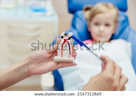 demonstration different stages caries on tooth model for little patient Royalty-Free Stock Photo #2167313869