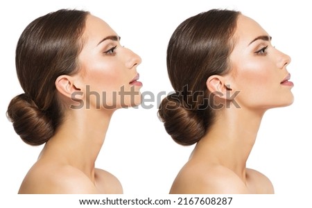 Woman Rhinoplasty. Women Nose Shape Before and After Plastic Surgery. Beauty Model Profile Side View over isolated White background Royalty-Free Stock Photo #2167608287