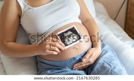 Ultrasound picture pregnant baby photo. Woman holding ultrasound pregnancy image. Concept of pregnancy, maternity, expectation for baby birth Royalty-Free Stock Photo #2167630285