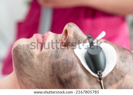 Woman patient taking carbon peel procedure face.