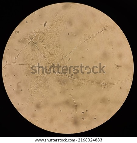 Microscopic view of hyphae of dermatophytes. fungus test. skin scraping, Diagnosis for fungal infection. Royalty-Free Stock Photo #2168024883