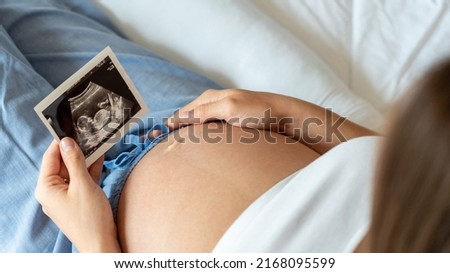 Ultrasound picture pregnant baby photo. Woman holding ultrasound pregnancy image. Concept of pregnancy, maternity, expectation for baby birth Royalty-Free Stock Photo #2168095599