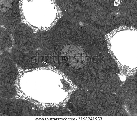 TEM micrograph showing hepatocyte plates located among three sinusoids. The hepatocyte cytoplasm shows many mitochondria and cisterns of RER and microvilli in Disse space around sinusoids Royalty-Free Stock Photo #2168241953