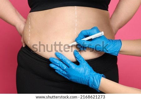 Doctor drawing marks on obese woman's body against pink background, closeup. Weight loss surgery Royalty-Free Stock Photo #2168621273
