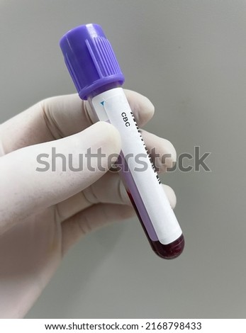 EDTA test tube Anticoaglant CBC test.Blood sample. Royalty-Free Stock Photo #2168798433
