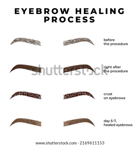 Eyebrows healing process after microblading. Healing stages eyebrows.  Royalty-Free Stock Photo #2169611153