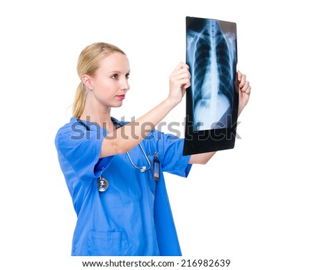 Female doctor hold with x ray