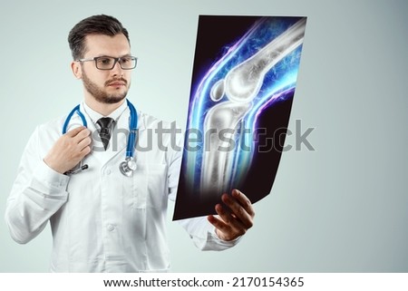 The doctor looks at the X-ray of the sore knee, severe pain. X-ray image, trauma, rheumatologist consultation, skeletal image, medical concept, medical technologies of the future, pain when walking Royalty-Free Stock Photo #2170154365