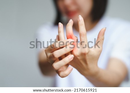 Woman has finger joint pain due to rheumatoid arthritis. Health care concept. Royalty-Free Stock Photo #2170615921