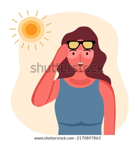 Young woman with skin sunburn under strong sunlight in flat design. Royalty-Free Stock Photo #2170897863