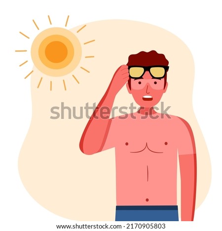 Young man with skin sunburn under strong sunlight in flat design. Royalty-Free Stock Photo #2170905803