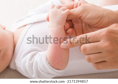 Young adult mother finger pointing to newborn arm with red rash. Allergy from milk formula or mother milk. Baby skin problem. Closeup. Side view. Royalty-Free Stock Photo #2171394857