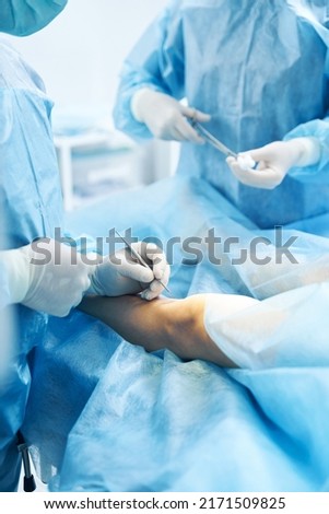 Surgical operation of lower limb conducted by professional doctor Royalty-Free Stock Photo #2171509825