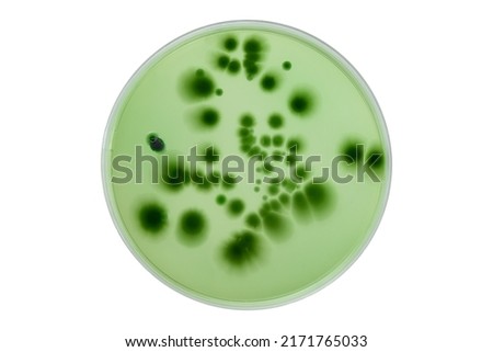 Hand with Petri dish or culture media with bacteria on white background with clipping, Test various germs, virus, Coronavirus, COVID-19, Microbial population count, Food science. Royalty-Free Stock Photo #2171765033