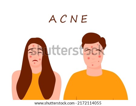Cartoon teenage character set with acne skin. Skin problems concept. Colorful vector illustration isolated on white background. Medicine and health care.