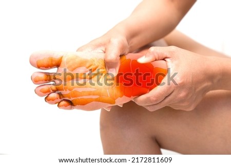 plantar fasciitis pain in the foot of the elderly.Symptoms of peripheral neuropathy. Most symptoms are numbness in the fingertips and foot. Royalty-Free Stock Photo #2172811609