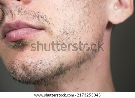 Short, sparse beard on mans face. Hair growth problems. Man with alopecia area in the beard. Unshaven bristles on the beard. Royalty-Free Stock Photo #2173253045