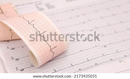 heart rhythm ekg note on paper doctors use to analyze heart disease treatment illustration on a white background Royalty-Free Stock Photo #2173435031