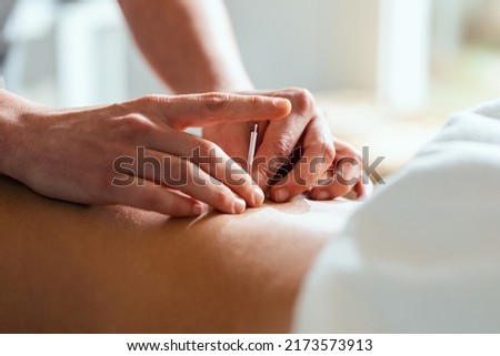 Close-up of young physiotherapist doing a trigger point injection in patient back. Royalty-Free Stock Photo #2173573913