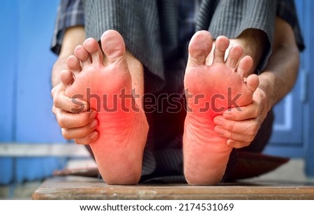 Tingling and burning sensation in feet of Asian old man with diabetes. Foot pain. Sensory neuropathy problems. Foot nerves problems. Plantar fasciitis. Royalty-Free Stock Photo #2174531069