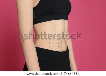 Slim woman with marks on body against pink background, closeup. Weight loss surgery Royalty-Free Stock Photo #2174664661