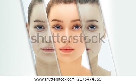 Effects of ageing,Frownscowl lines ,Nasolabial folds,Neck ,Under eye circles,neck lines. Plastic Surgery Results Royalty-Free Stock Photo #2175474555