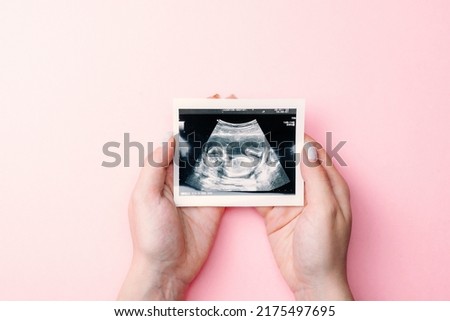 Ultrasound photo pregnancy baby. Woman hands holding ultrasound pregnant picture on pink background. Concept maternity, pregnancy, childbirth