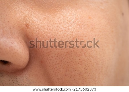 Asian male nose and cheek close up has skin problem, large pores, whitehead and blackhead pimple. Pores on the face of a man. Royalty-Free Stock Photo #2175602373