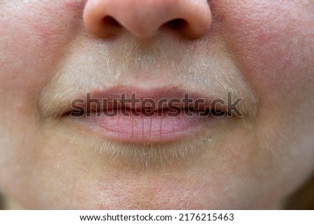Natural hairy upper lip of a body positive young woman. Close up.
