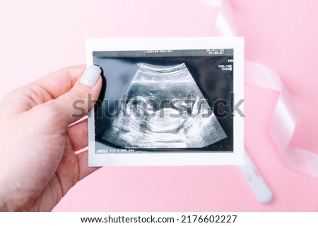 Ultrasound photo pregnancy baby. Woman hands holding ultrasound pregnant picture on pink background. Concept maternity, pregnancy, childbirth. Royalty-Free Stock Photo #2176602227
