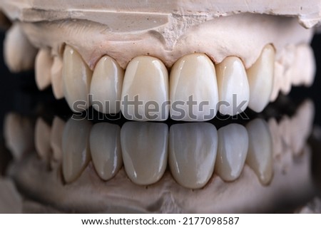 Dental health care. Ceramic zirconium in final version. Close up dental zircon ceramic crowns on black background Royalty-Free Stock Photo #2177098587
