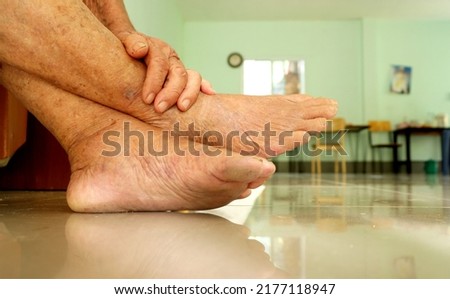 Close-up elderly man sitting on a hammock with pain in his leg and feeling pain. Royalty-Free Stock Photo #2177118947