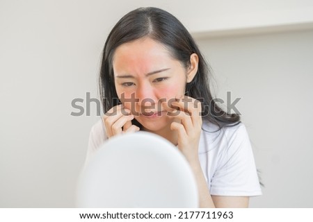 Dermatology, puberty asian young woman, girl looking into mirror, allergy presenting an allergic reaction from cosmetic, red spot or  rash on face. Beauty care from skin problem by medical treatment. Royalty-Free Stock Photo #2177711963