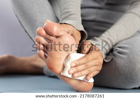 Hyperhidrosis, The woman wipes her feet after they have been excessively perspiring. Royalty-Free Stock Photo #2178087261