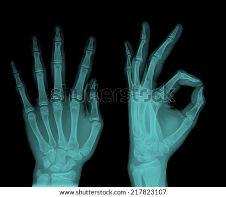 pair of hand on black background, x-ray